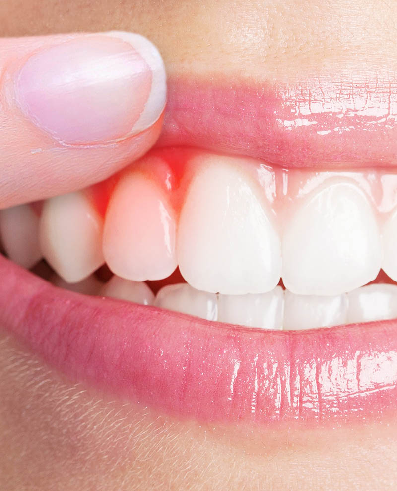 oral health problems in NYC | gum health nyc | periodontal disease nyc