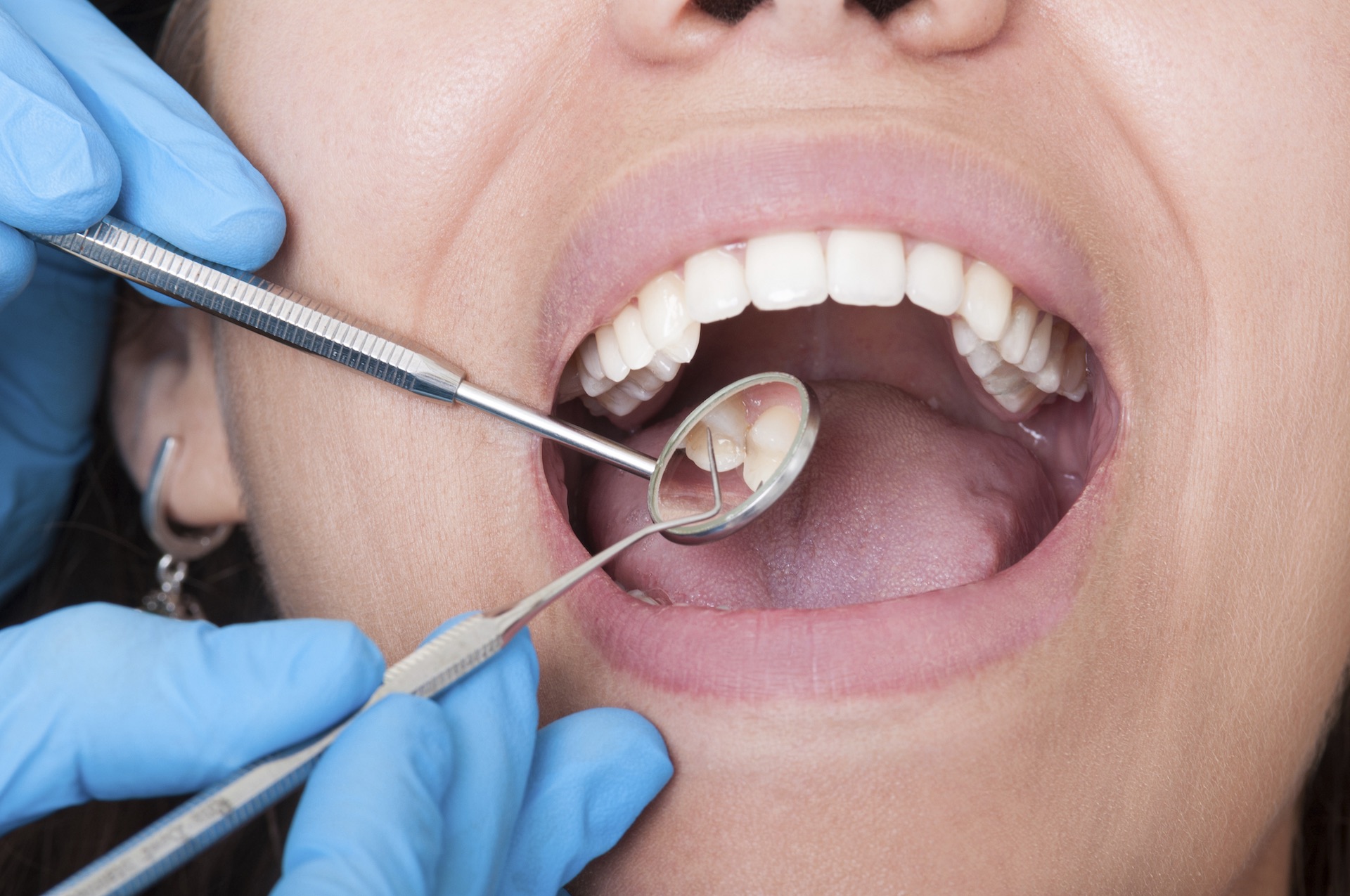 24 hour dentist NYC | JBL New York City Dental Cleaning